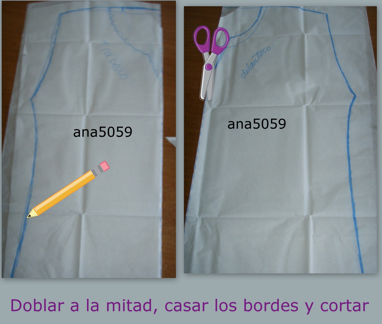 Los granos sobre la espalda y el tórax de la causa y el tratamiento